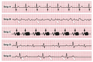 ECG strips Image